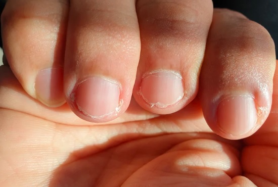 How to strengthen weak nails