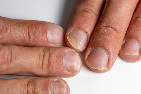 hand and nail theory course